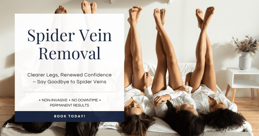 Spider vein removal services