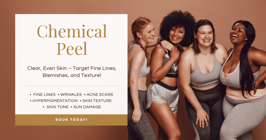 Chemical peel services