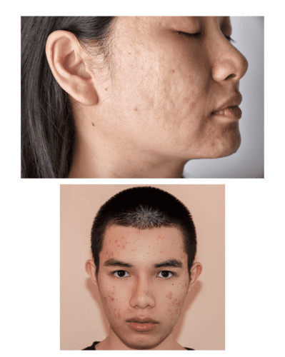 Skincare treatments