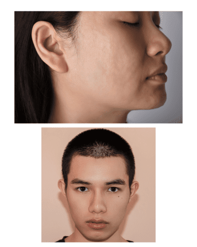skincare treatments
