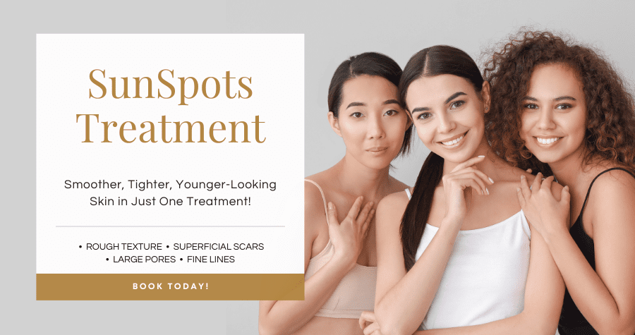 Sun Spot treatment