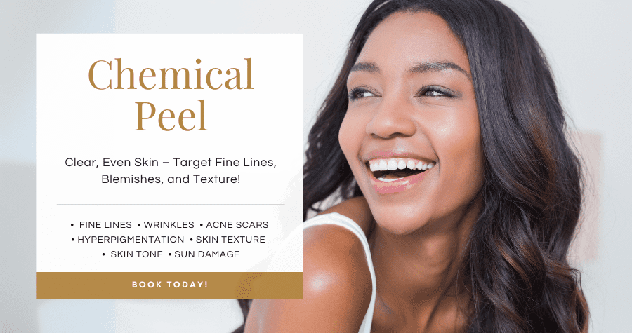 Chemical peels services