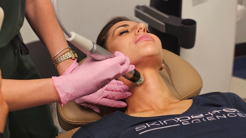 RF microneedling enlarged pores treatment improving skin texture